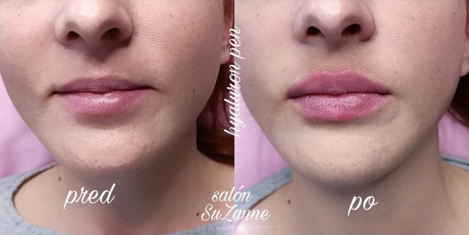 Naša práca — kozmetický salón SuZanne