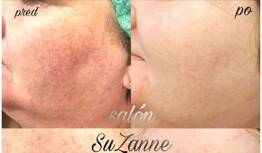 Naša práca — kozmetický salón SuZanne